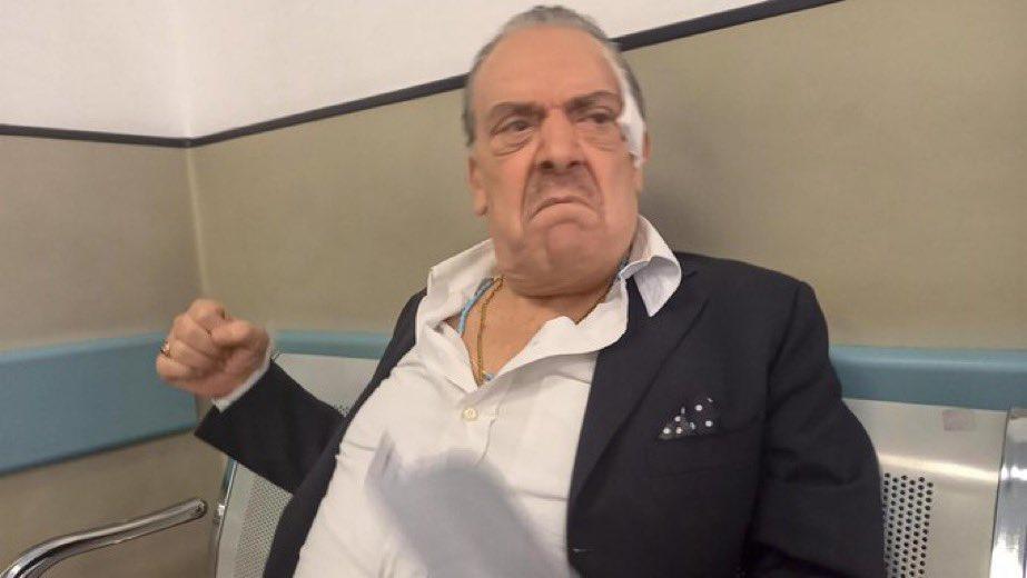 Актер напал на 79-летнего “короля папарацци”