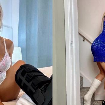 Модель симулирует переломы и зарабатывает кучу денег