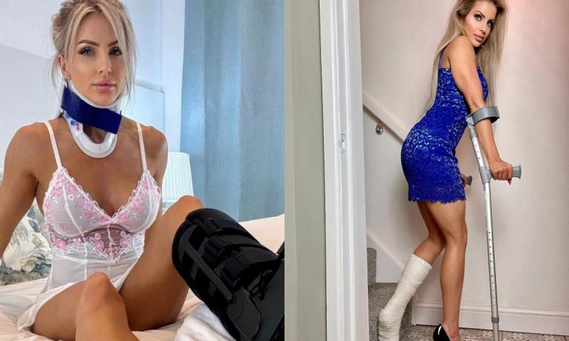 Модель симулирует переломы и зарабатывает кучу денег Модель симулирует переломы и зарабатывает кучу денег