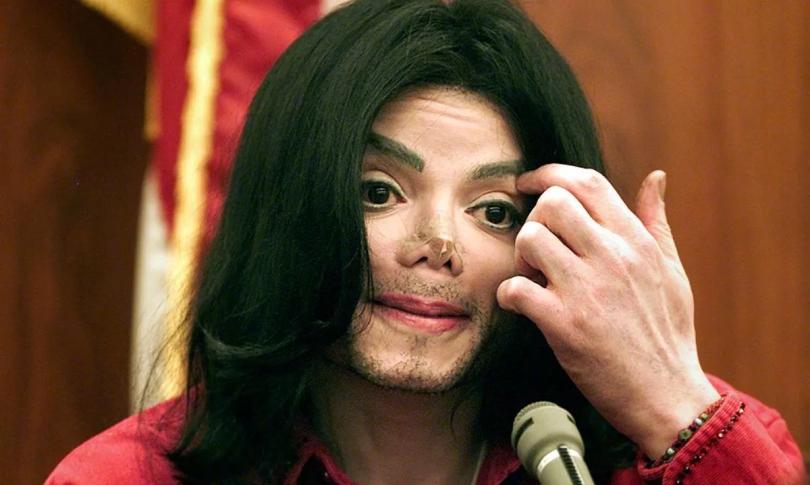 Загадочные шрамы Майкла Джексона. Загадочные шрамы Майкла Джексона.