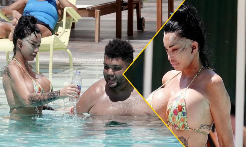 Кэти Прайс после операции