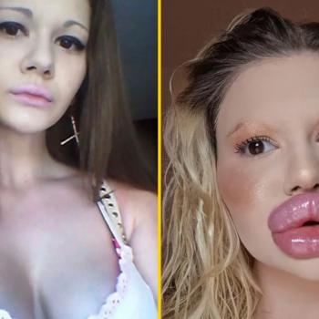 «Болгарская Барби» утверждает, что у неё самые большие губы в мире