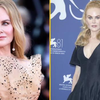 Николь Кидман и ее неподвижный лоб выглядят шикарно