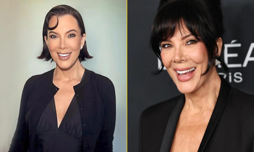 Крис Дженнер честно говорит о пластической хирургии